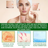 Acne Clear Serum